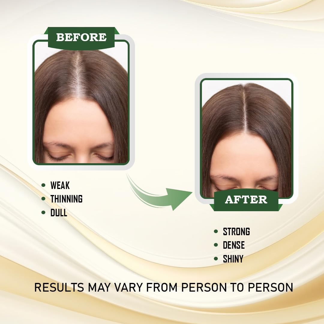Combo for Hair Growth | 100% Ayurvedic Hair Oil 100ml & Nutraceutical 30 Hair Mass Tablets | Reduces Hair Fall, Strengthens Roots, Boosts Shine & Volume | Ayurvedic Herbs, Biotin & Essential Nutrients | 100% Vegan (2)