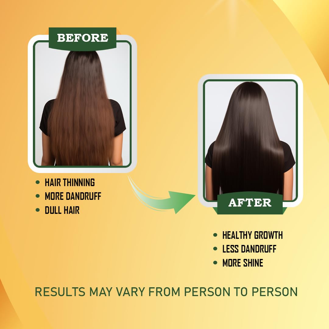 Complete Hair Care Combo Pack | Ayurvedic Hair Mass Oil 100ml, Cleanser/Shampoo 200ml & Hair Mass Tablets 30 | Power of Essential Ingredients such as Bhringraj, Neem & Biotin (1)