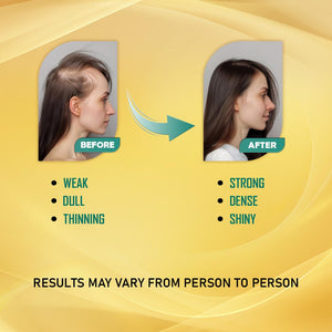 Tablets for Hair Growth & Strength | Nutraceutical Hair Supplement | Power of 34 Ingredients with Biotin, Peet Bhring Raja, Grape Seed Extract | Reduces Hair Fall, Boosts Shine, Nourishes Scalp | 30 Tablets| 100% Vegan (1)