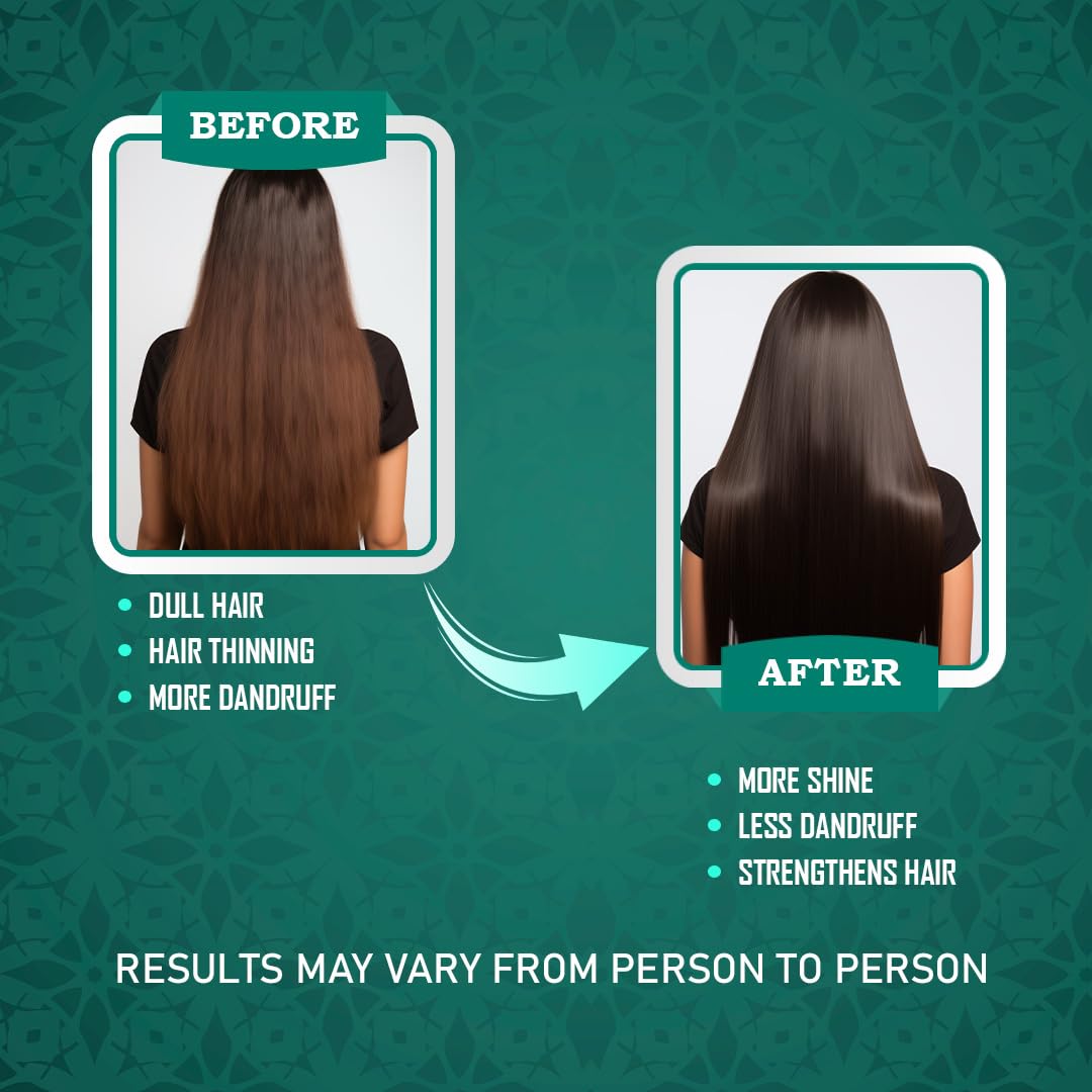 Oil 100ML & Hair Mass Cleanser/Shampoo 200ML Combo Pack | Ayurvedic Hair Care with Bhringraj, Neem, Methi & Reetha | For Dandruff & Lice Control | Anti Hair Fall Kit | FDA Approved, Suitable for All Hair Types (1)